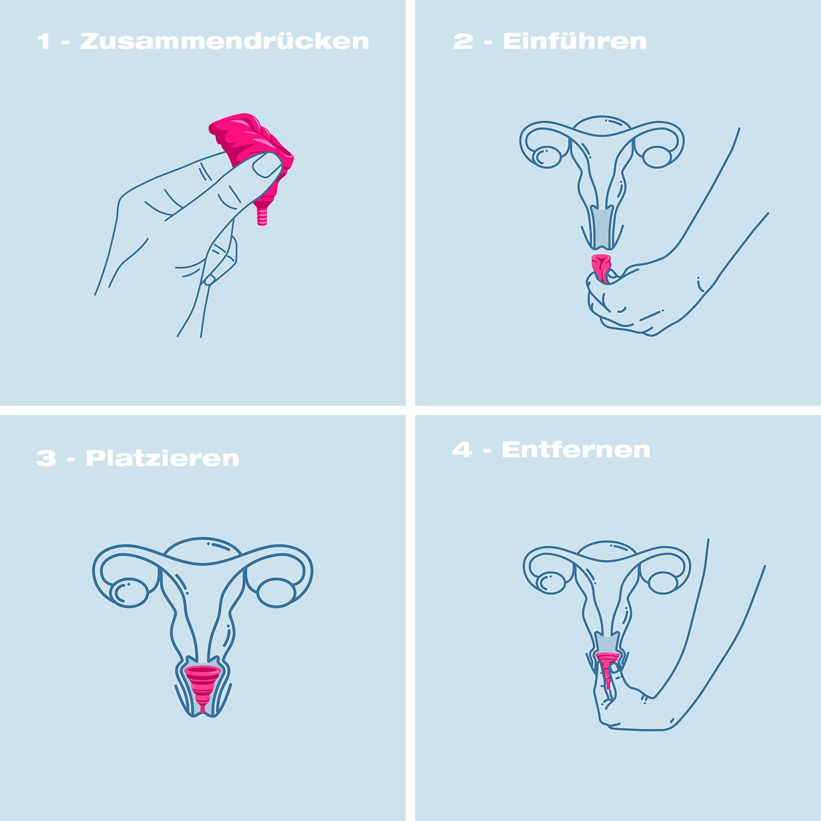 intimina-lily-cup-compact-gr-e-a-menstruationstasse-faltbar image 5